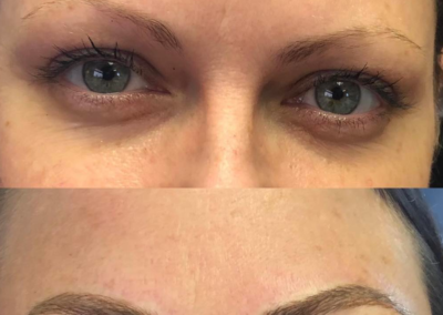 Lisa Wilson Albany, Salem, Permanent Makeup